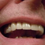 Smil med selvtillid: Sådan vælger du den rette tandlæge