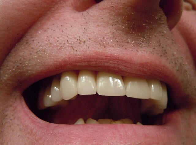 Smil med selvtillid: Sådan vælger du den rette tandlæge